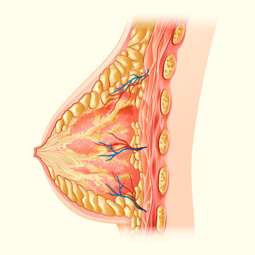 Causas de la caída de los senos: cambios estructura de la mama