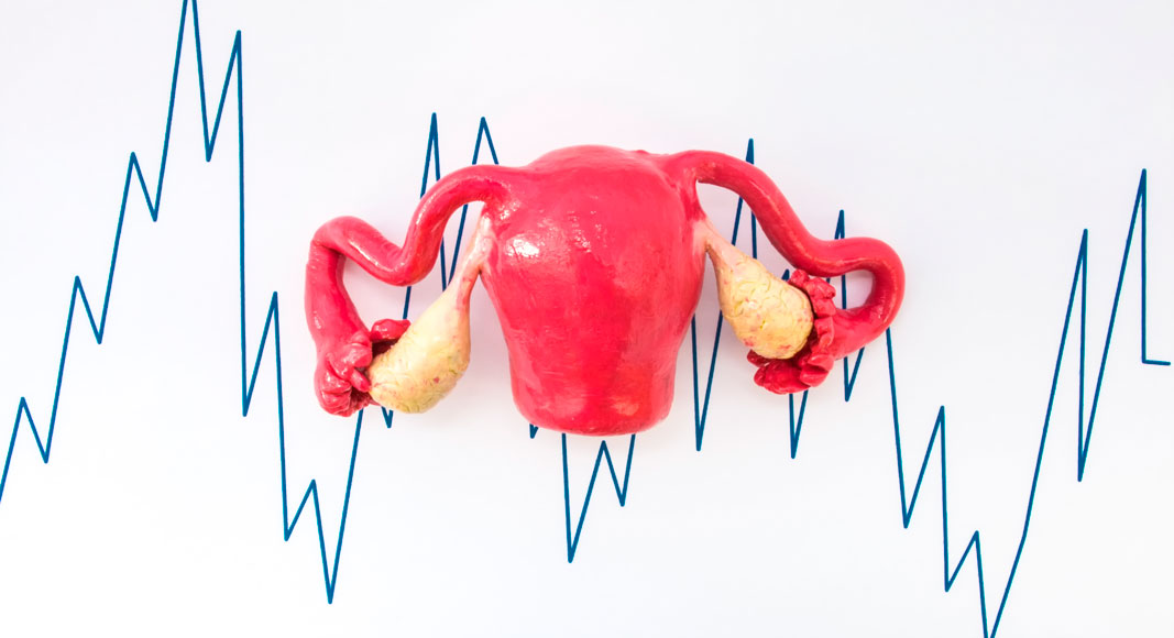 Problemas de atonía uterina