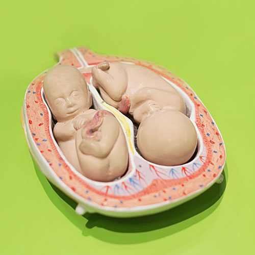 Causas de la irritabilidad uterina: embarazo múltiple