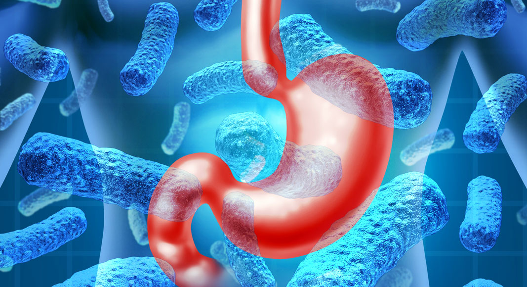 Gastroenteritis