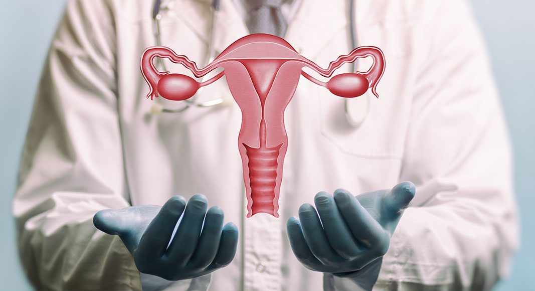 síndrome de relajación vaginal: cirugía