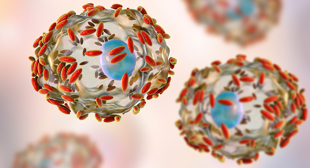 Vaginosis bacteriana