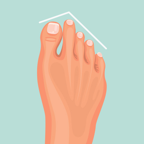 Tipos de pie: pie griego