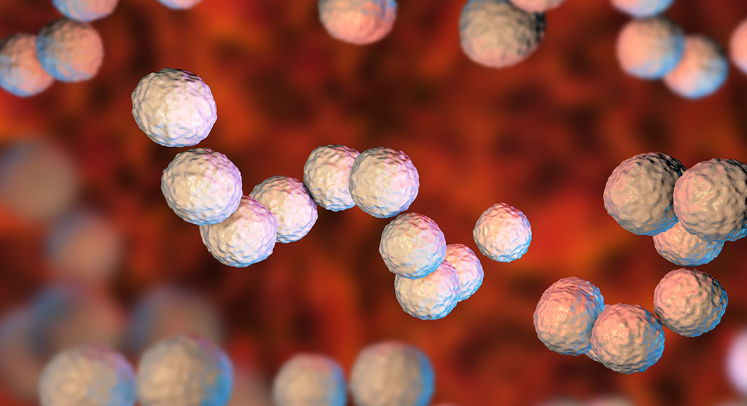 Causas del impétigo