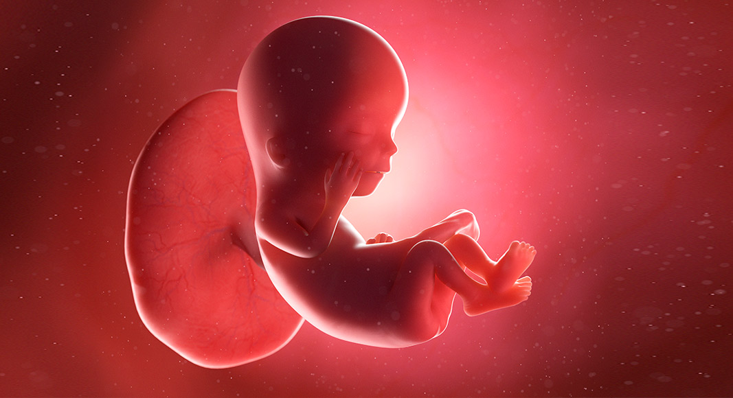 Tipos de neumonía neonatal: congénita