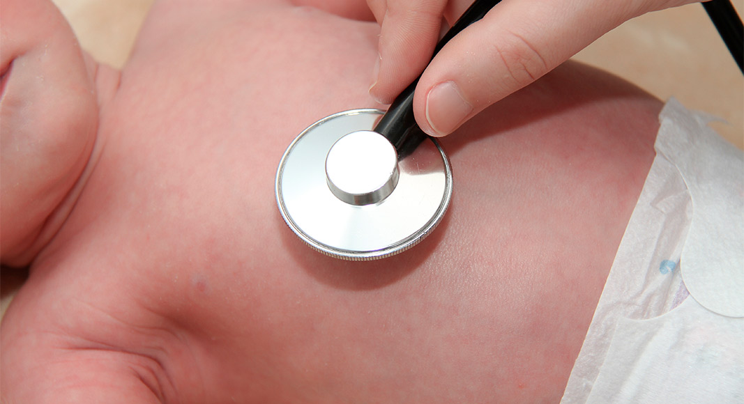 Tipos de neumonía neonatal: postnatal