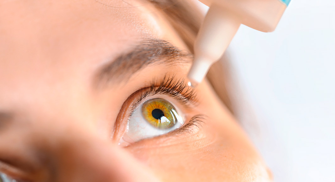 Beneficios atribuidos al aceite de ricino: ojos irritados