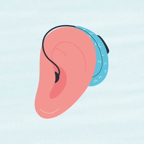 Por qué te pican los oídos: audífonos