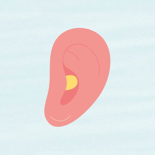 Por qué te pican los oídos: tapones de cera