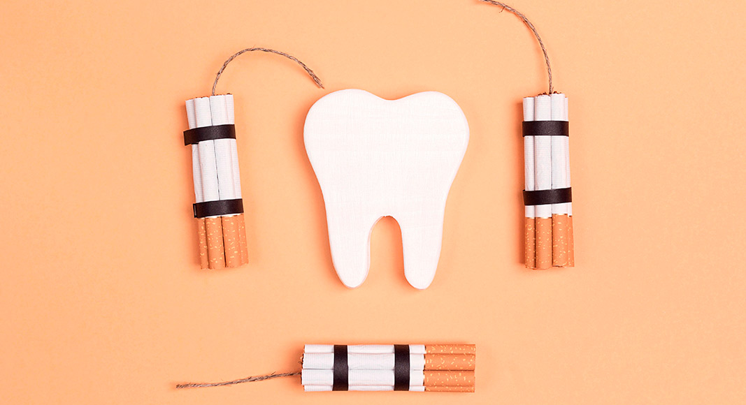 El tabaco daña la salud dental