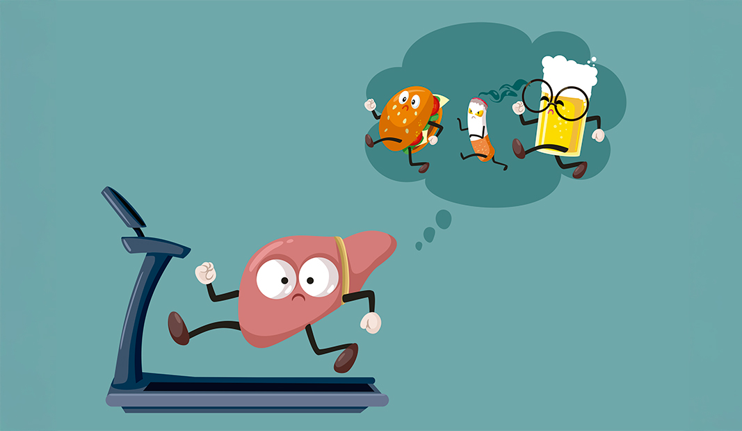 Un estilo de vida poco saludable afecta al hígado Ilustración de un estilo de vida poco saludable afecta al hígado