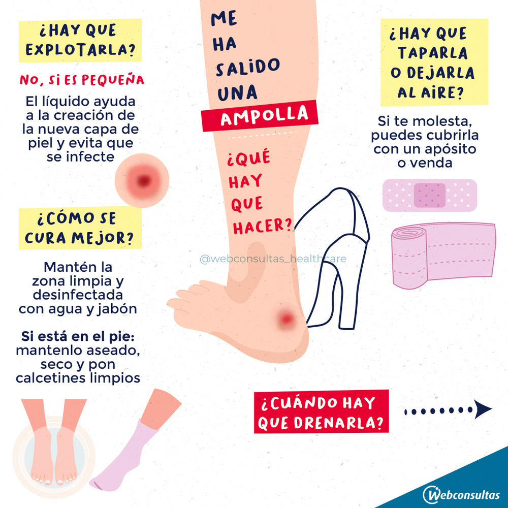 Infografía Ampollas 1 Infografía Ampollas 1