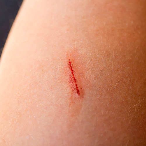 Ducharse en la playa