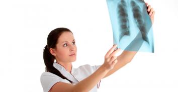 Médico mirando una radiografía de los pulmones