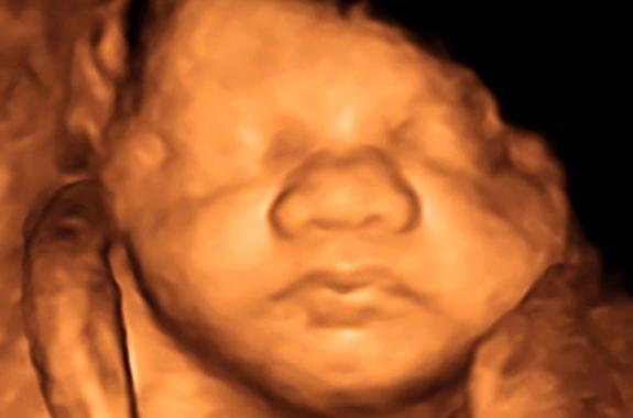 Vista de un feto humano en el interior del vientre de su madre