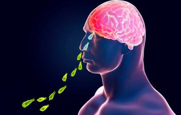 Ameba comecerebros, un parásito mortal Ameba comecerebros, un parásito mortal