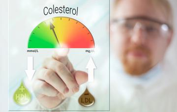 Causas de la hipercolesterolemia