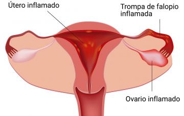 Dibujo de aparato genital femenino