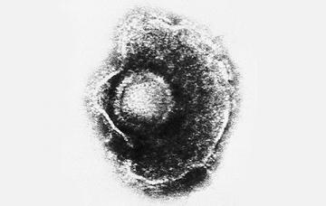 Reactivación del virus de la varicela-zóster