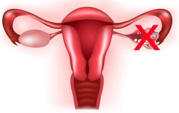 Cese de la función ovárica