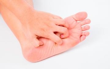 Causas del pie de atleta