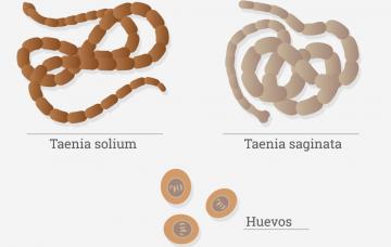 Causas de la teniasis Causas de la teniasis