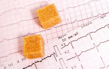Complicaciones cardiovasculares asociadas a la diabetes