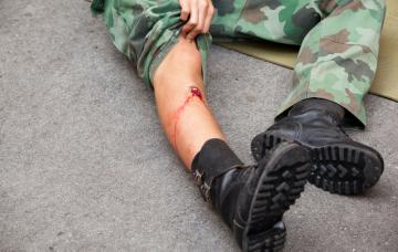Consecuencias y complicaciones de una herida por arma de fuego Consecuencias y complicaciones de una herida por arma de fuego