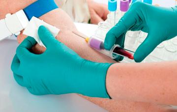 Diagnóstico de la enfermedad de Addison