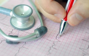 Diagnóstico de una arritmia