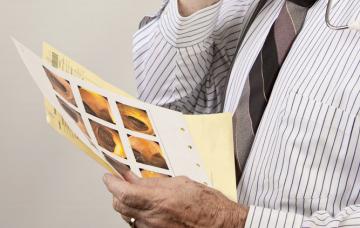 Diagnóstico del colon irritable Diagnóstico médico del intestino irritable