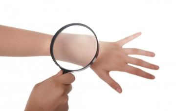 Diagnóstico dermatológico de la dermatitis atópica