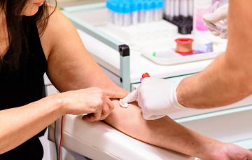 Diagnóstico analítico del síndrome de fatiga crónica