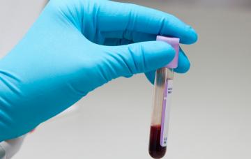 Mano enguantada sujeta un recipiente de laboratorio