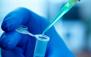 Diagnóstico del Huntington Diagnóstico del Huntington