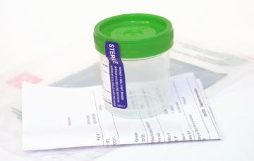 Diagnóstico de la incontinencia urinaria Análisis para la incontinencia urinaria