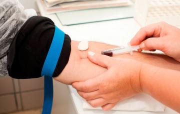 Analítica para el diagnóstico de insuficiencia renal crónica