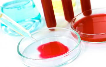 Diagnóstico de la leptospirosis Diagnóstico de la leptospirosis