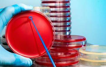 Diagnóstico de la salmonelosis en un hemocultivo