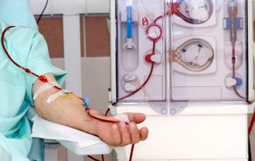 Diálisis para el tratamiento de la insuficiencia renal crónica