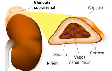 Ilustración de las causas de la enfermedad de Addison