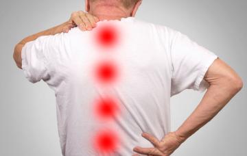 Dolor óseo como síntoma del mieloma múltiple