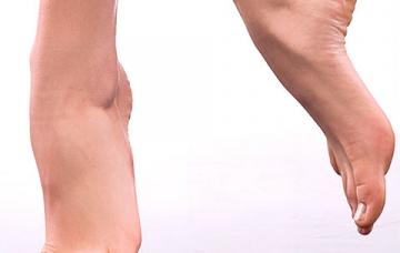 Neuropatía diabética periférica
