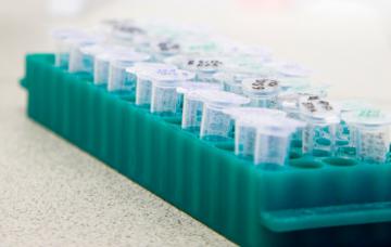 Diagnístico genético para prevenir la distrofia muscular de Duchenne