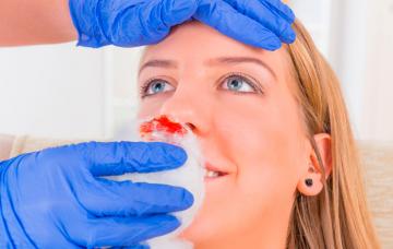 Un sanitario atiende a una joven con hemorragia nasal