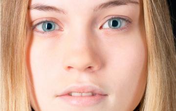 Síntomas de la anemia Síntomas de anemia en adolescente