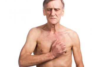 Síntomas del cáncer de esófago Disfagia en cáncer de esófago