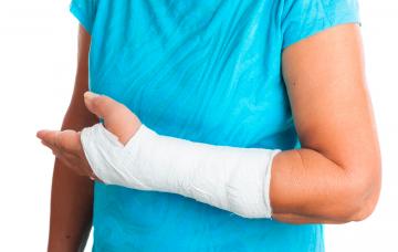 Mujer con brazo fracturado por osteoporosis