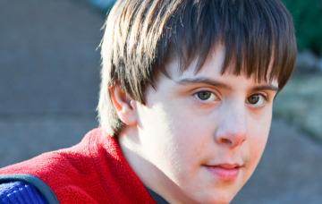 Hombre con síntomas del síndrome de X frágil