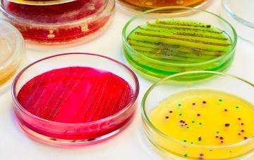Tipos de candidiasis en muestras de laboratorio Tipos de candidiasis